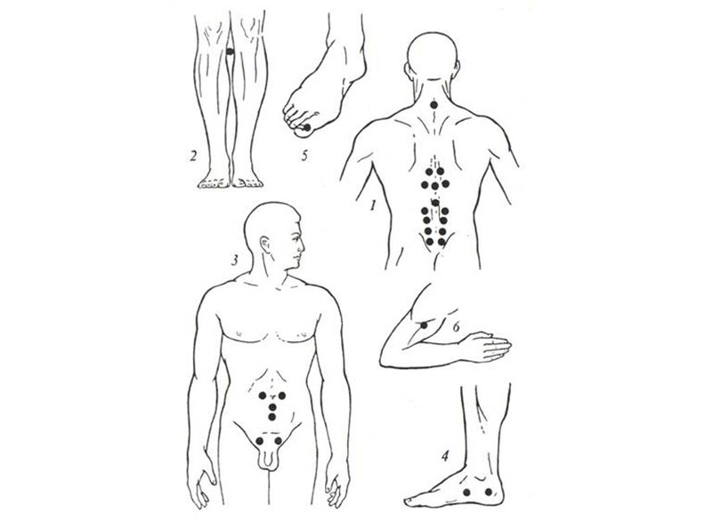 Masaje de acupuntura